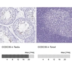 Anti-CCDC39 Antibody