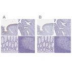 Immunohistochemical staining of human bronchus, fallopian tube, rectum and tonsil using Anti-CCDC39 antibody HPA035364 (A) shows similar protein distribution across tissues to independent antibody HPA035363 (B).