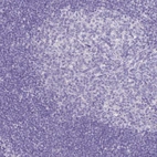 Immunohistochemical staining of human tonsil shows no positivity in lymphoid cells as expected.