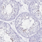 Immunohistochemical staining of human testis shows strong cytoplasmic positivity in spermatozoa.