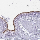 Immunohistochemical staining of human bronchus shows strong positivity in cilia in glandular cells.