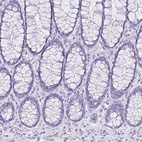 Immunohistochemical staining of human rectum shows no positivity in glandular cells as expected.