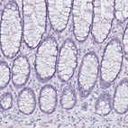 Immunohistochemical staining of human rectum shows no positivity in glandular cells as expected.