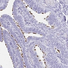 Immunohistochemical staining of human fallopian tube shows strong positivity in cilia in glandular cells.