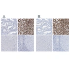 Immunohistochemical staining of human endometrium, liver, pancreas and tonsil using Anti-AGXT antibody HPA035371 (A) shows similar protein distribution across tissues to independent antibody HPA035370 (B).