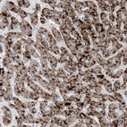 Immunohistochemical staining of human liver shows strong granular positivity in cytoplasm in hepatocytes.