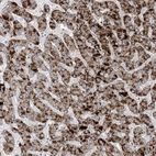 Immunohistochemical staining of human liver shows strong granular positivity in cytoplasm in hepatocytes.