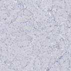 Immunohistochemical staining of human pancreas shows no positivity in exocrine glandular cells as expected.