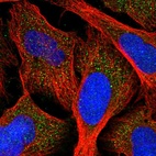 Immunofluorescent staining of human cell line U-2 OS shows localization to vesicles.