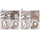 Anti-NDUFAF3 Antibody