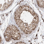 Immunohistochemical staining of human testis shows strong granular cytoplasmic positivity in cells in seminiferous ducts.