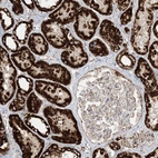 Immunohistochemical staining of human kidney shows strong granular cytoplasmic positivity in cells in tubules.