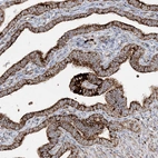 Immunohistochemical staining of human Fallopian tube shows strong granular cytoplasmic positivity in glandular cells.
