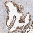 Immunohistochemical staining of human prostate shows strong granular cytoplasmic positivity in glandular cells.