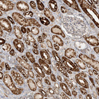 Immunohistochemical staining of human kidney shows strong granular cytoplasmic positivity in cells in tubules.