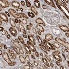 Immunohistochemical staining of human kidney shows strong granular cytoplasmic positivity in cells in tubules.