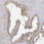 Immunohistochemical staining of human prostate shows moderate granular cytoplasmic positivity in glandular cells.