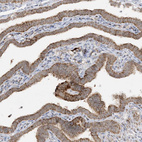 Immunohistochemical staining of human Fallopian tube shows moderate granular cytoplasmic positivity in glandular cells.