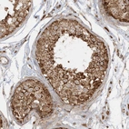 Immunohistochemical staining of human testis shows strong granular cytoplasmic positivity in cells in seminiferous ducts.
