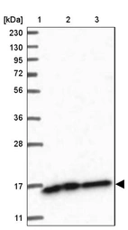 Lane 1: Marker [kDa] 230, 130, 95, 72, 56, 36, 28, 17, 11_br/_Lane 2: Human cell line RT-4_br/_Lane 3: Human cell line U-251MG sp