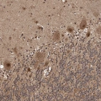 Anti-UBR3 Antibody