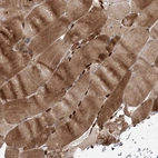 Immunohistochemical staining of human skeletal muscle shows strong cytoplasmic membranous and and nuclear positivity in myocytes.