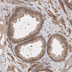 Immunohistochemical staining of human prostate shows moderate membranous and cytoplasmic positivity in glandular cells.