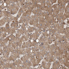 Immunohistochemical staining of human liver shows moderate membranous and cytoplasmic positivity in hepatocytes.