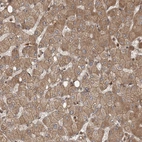 Immunohistochemical staining of human liver shows moderate membranous and cytoplasmic positivity in hepatocytes.
