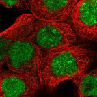 Immunofluorescent staining of human cell line A-431 shows localization to nucleus & nucleoli.