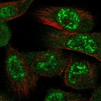 Anti-PRKAA1 Antibody