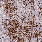 Anti-MAP3K3 Antibody
