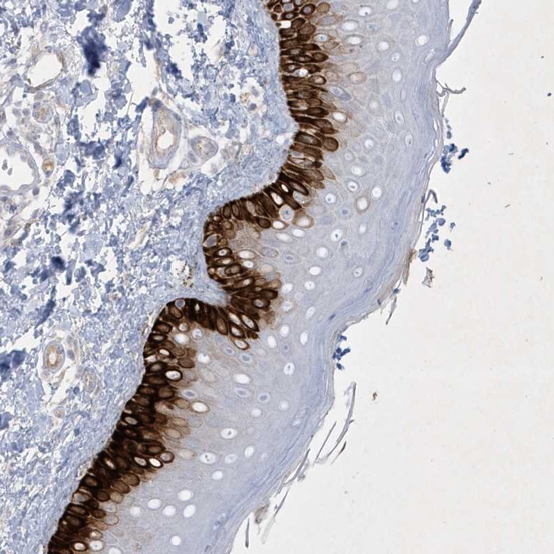 Anti-CCDC24 Antibody