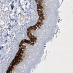 Anti-CCDC24 Antibody