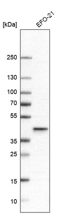 Western blot analysis in human cell line EFO-21.
