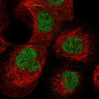Immunofluorescent staining of human cell line A-431 shows localization to nucleoplasm.