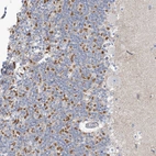 Immunohistochemical staining of human granular layer of the cerebellum shows moderate to strong cytoplasmic positivity.