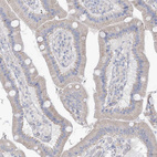 Anti-MTHFD2L Antibody