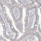 Immunohistochemical staining of human duodenum shows weak to moderate cytoplasmic positivity in glandular cells.