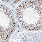 Immunohistochemical staining of human testis shows strong nuclear positivity in cells in seminiferous ducts.