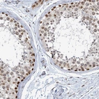 Immunohistochemical staining of human testis shows strong nuclear positivity in cells in seminiferous ducts.