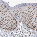 Immunohistochemical staining of human skin shows strong nuclear positivity in squamous epithelial cells.
