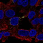 Anti-ECHDC1 Antibody