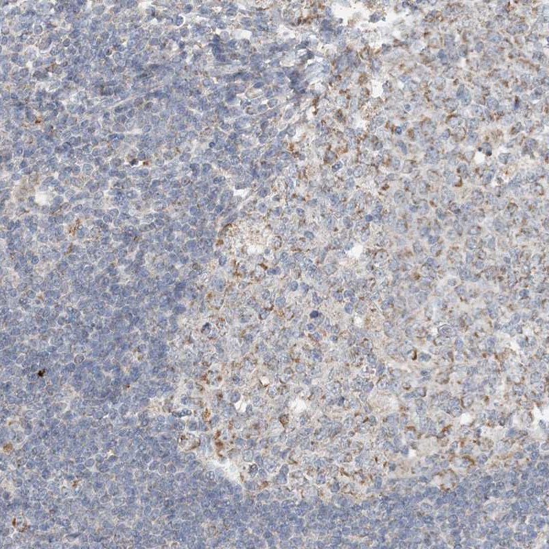 Anti-SFMBT2 Antibody