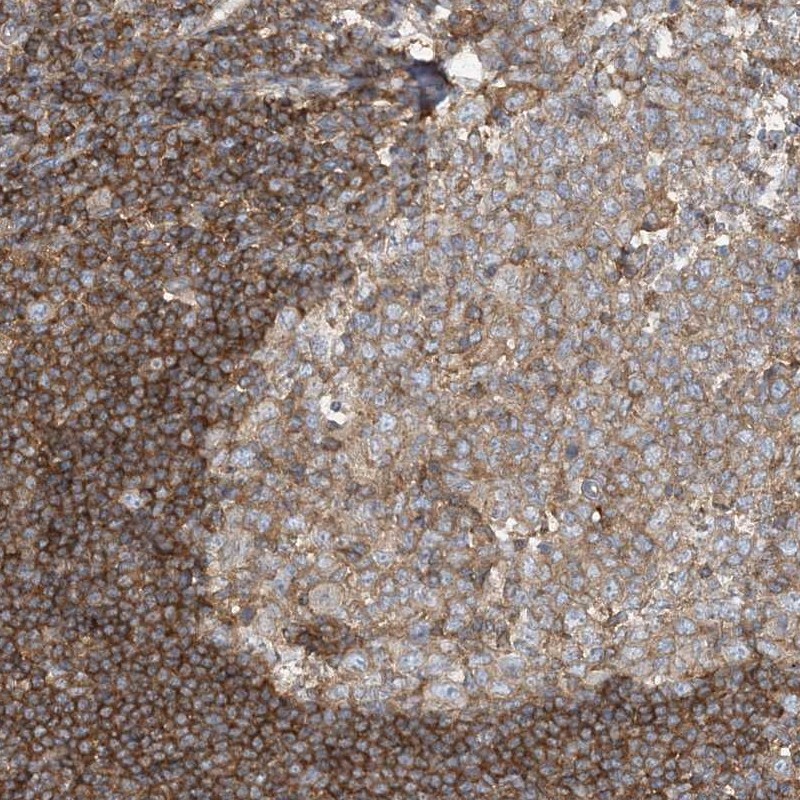 Anti-SFMBT2 Antibody