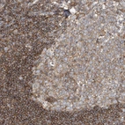 Anti-SFMBT2 Antibody