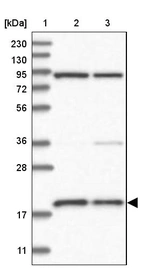 Lane 1: Marker [kDa] 230, 130, 95, 72, 56, 36, 28, 17, 11_br/_Lane 2: Human cell line RT-4_br/_Lane 3: Human cell line U-251MG sp