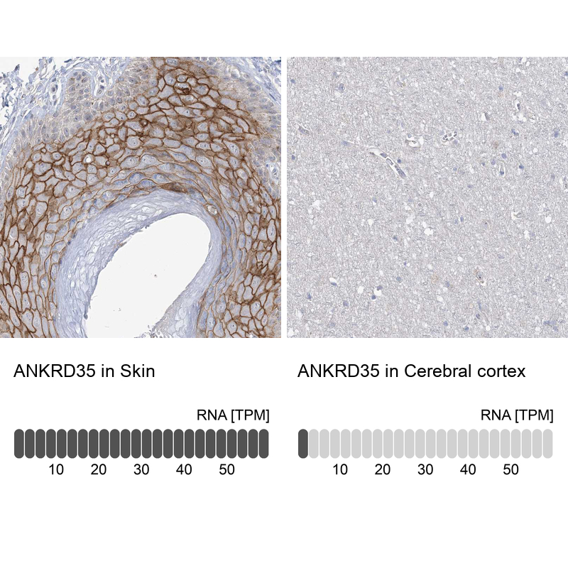 Anti-ANKRD35 Antibody