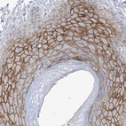 Immunohistochemical staining of human skin shows strong membranous positivity in squamous epithelial cells.