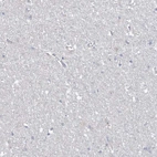Immunohistochemical staining of human cerebral cortex shows no positivity in neurons as expected.